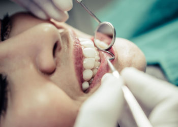 O que você ainda não sabe sobre a cárie!