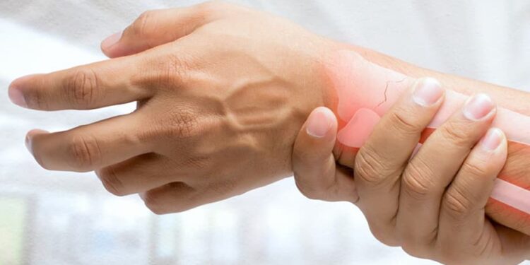 Gota: saiba o que é e como prevenir a doença
